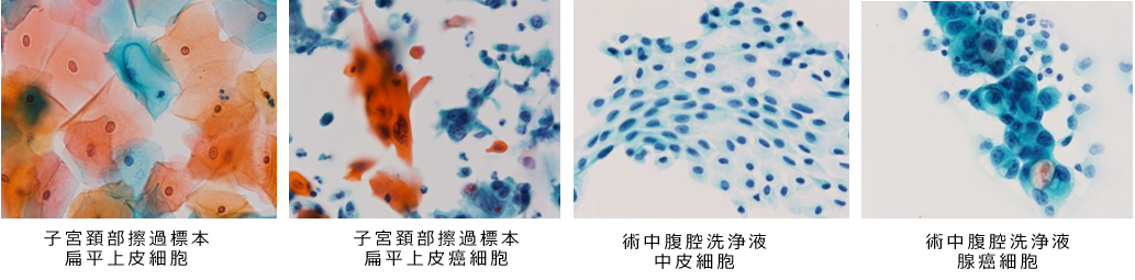 細胞診断