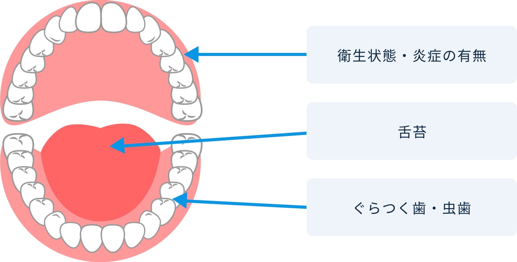 口腔イメージ